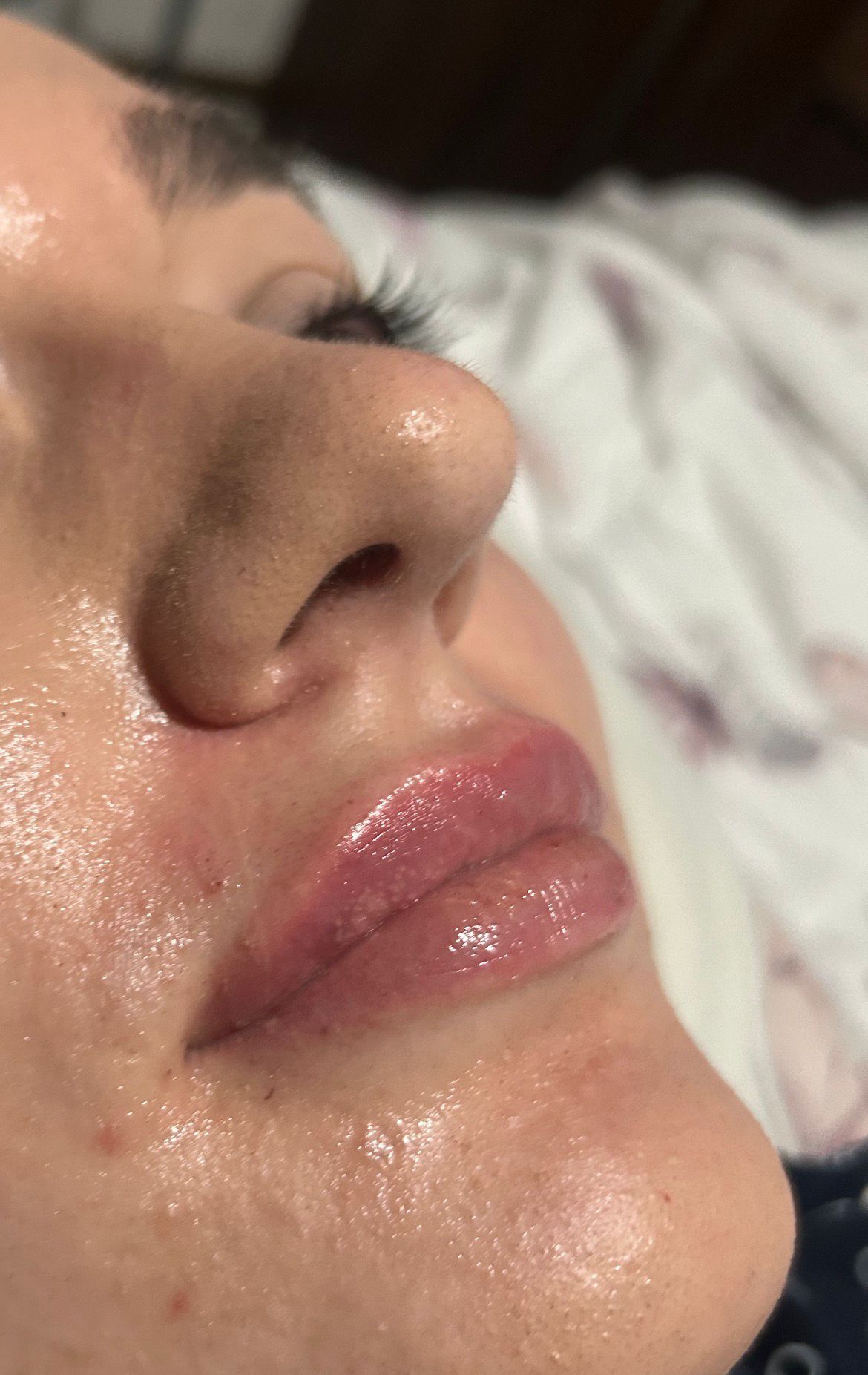 Golden Glow Aesthetics treatment